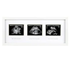 Pearhead - Trimester Sonogram Frame, White - cutbabycare.com | baby boutique & care hub* New