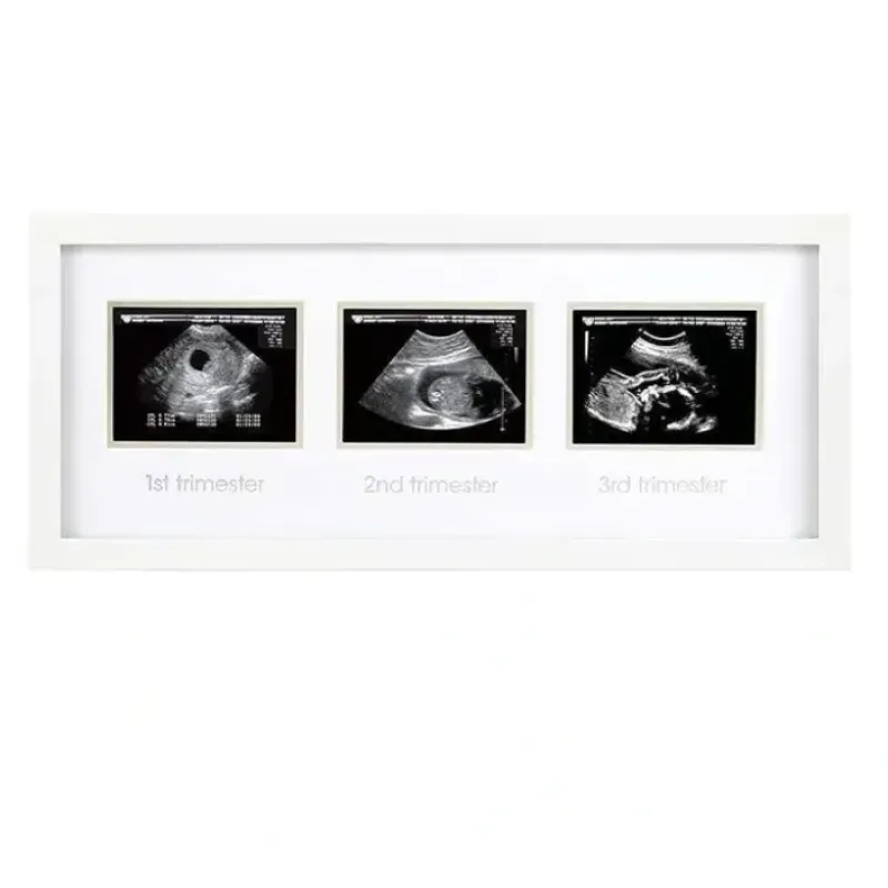 Pearhead - Trimester Sonogram Frame, White - cutbabycare.com | baby boutique & care hub* New